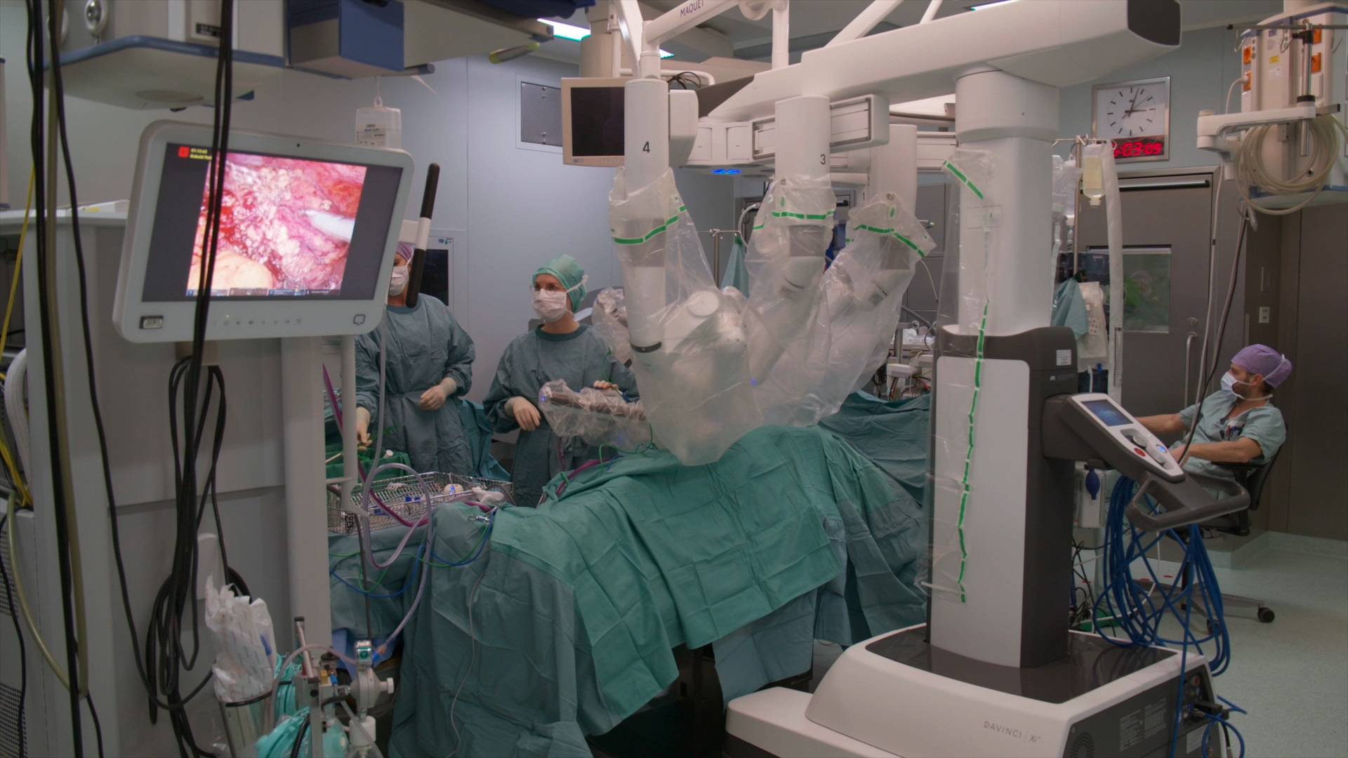 „da Vinci“ macht Spitäler zukunftsfit